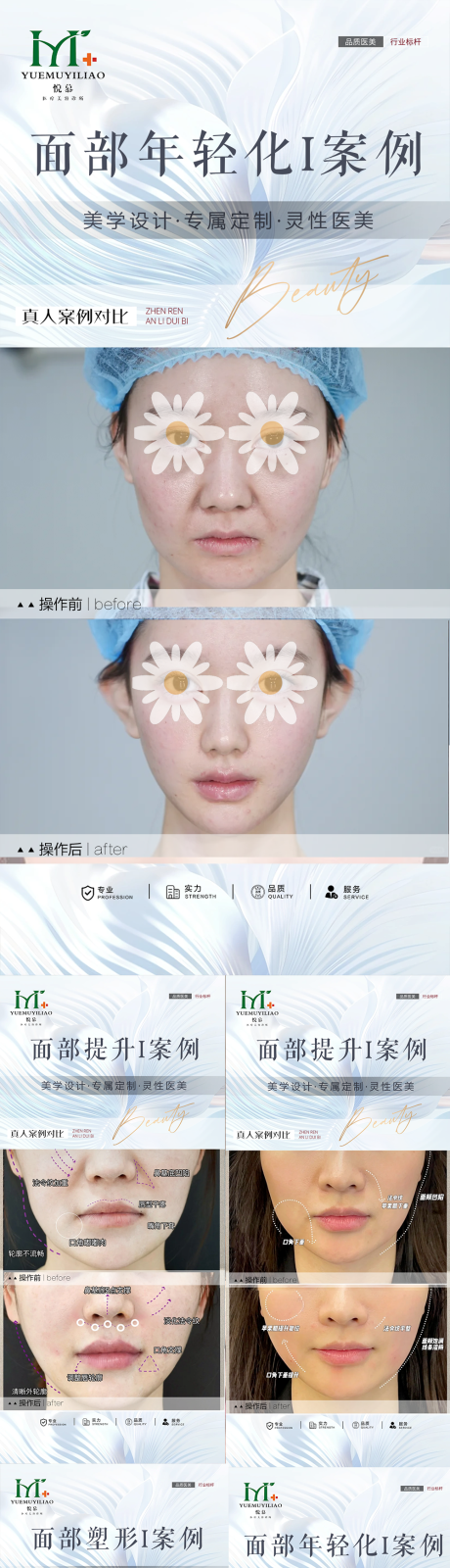 源文件下载【享设计】搜索编号：42040030237764678【医美整形案例海报】