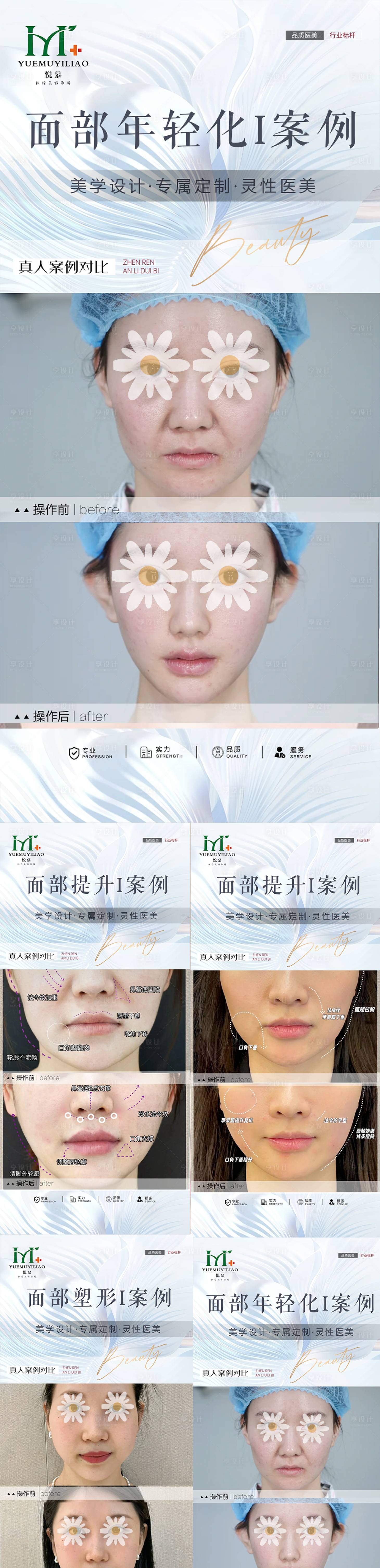 源文件下载【享设计】搜索编号：42040030237764678【医美整形案例海报】