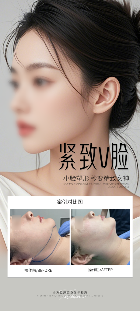 源文件下载【医美V脸案例海报】编号：34910030807578781