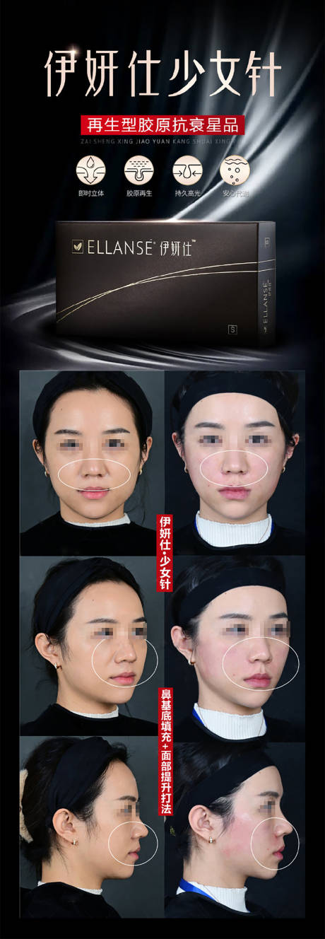 少女针案例长图