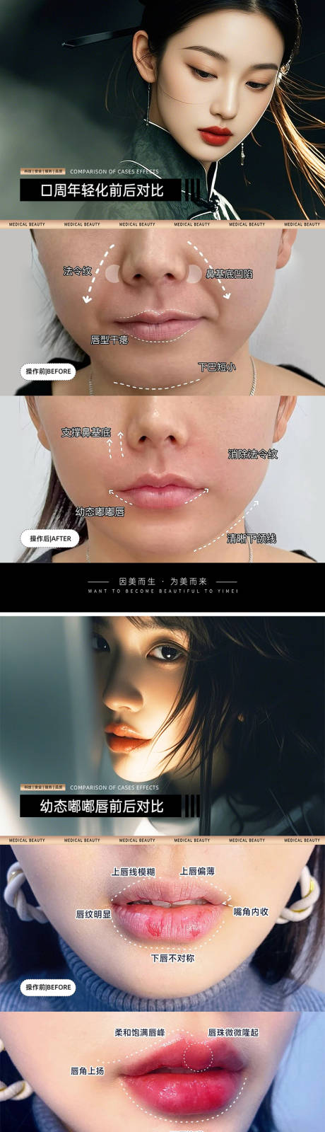 源文件下载【医美案例对比模板系列海报】编号：21550030891027184