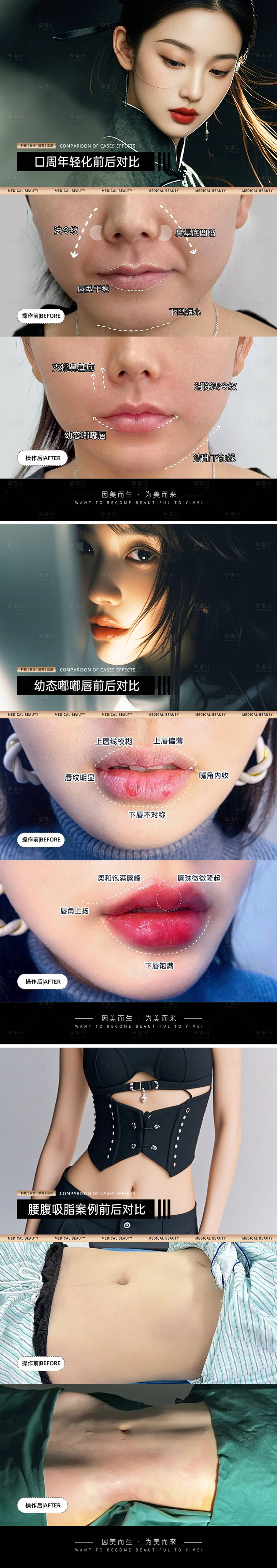源文件下載【享設計】搜索編號：21550030891027184【醫美案例對比模板系列海報】