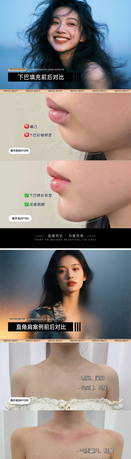 源文件下载【享设计】搜索编号：65130030923848843【医美案例对比模板海报】