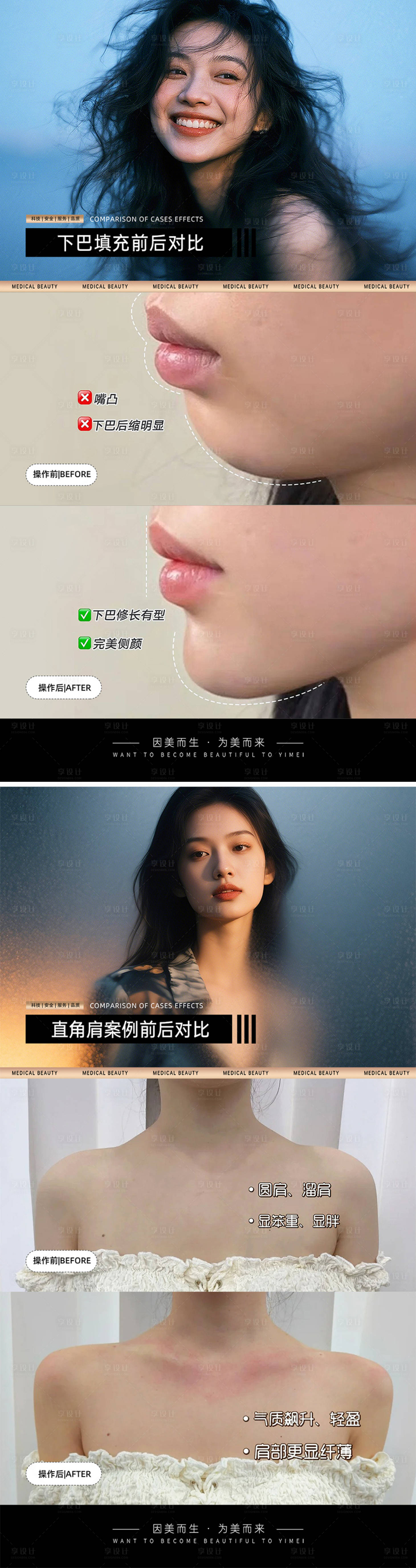 源文件下载【享设计】搜索编号：65130030923848843【医美案例对比模板海报】