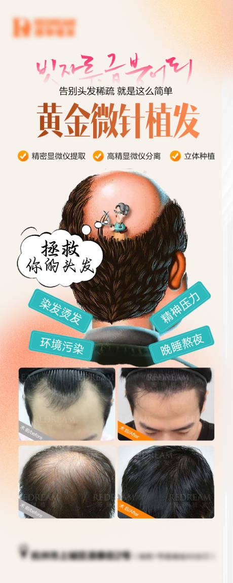 源文件下载【医美植发案例海报】编号：50800030525109834