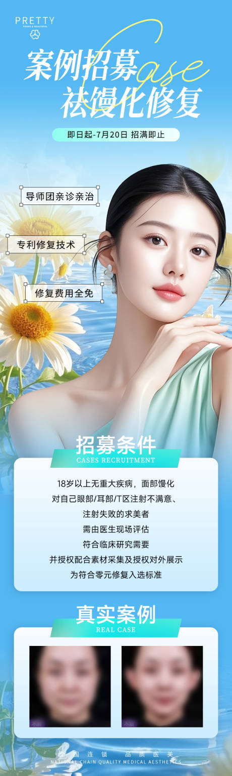 源文件下載【醫美海報藍色案例招募長圖活動】編號：19200031041742964
