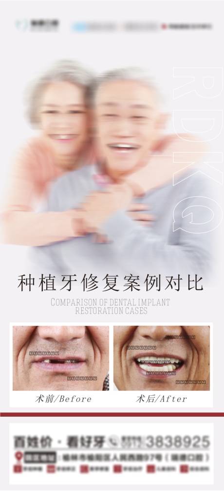源文件下載【享設(shè)計(jì)】搜索編號(hào)：90970030639216856【口腔種植真實(shí)案例海報(bào)】