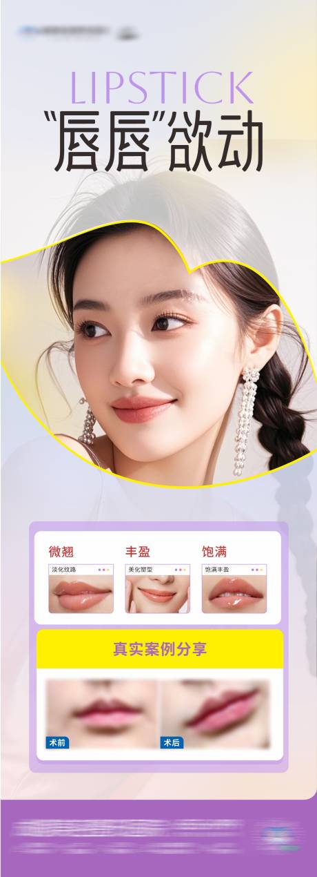 源文件下载【医美唇部塑形案例创意海报】编号：73680030523741746