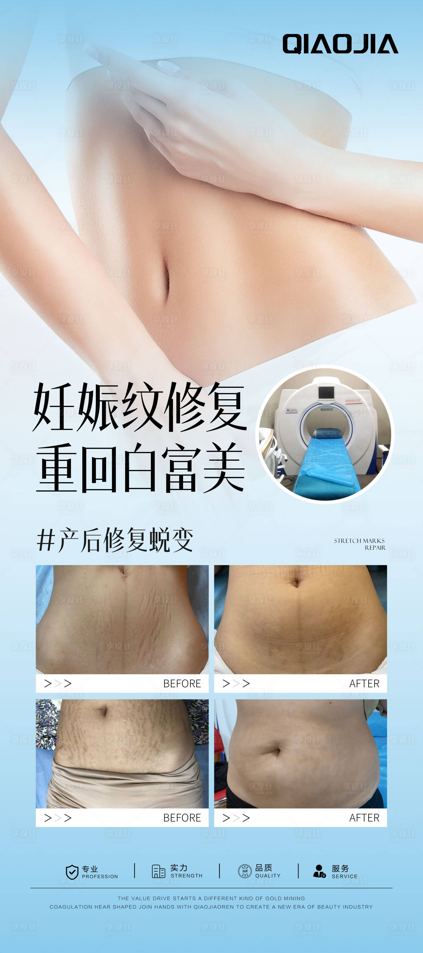 源文件下载【享设计】搜索编号：25550030527366535【妊娠纹案例对比】