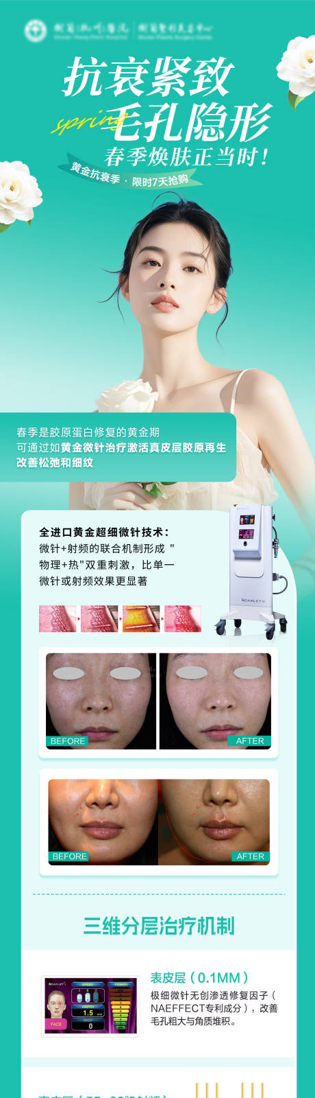 源文件下载【黄金超微针抢购海报】编号：79020031028498542