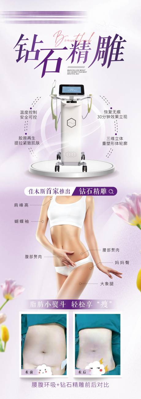 钻石精雕宣传对比图