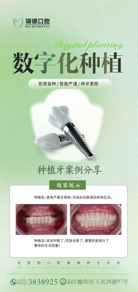 源文件下載【享設計】搜索編號：70350030638421936【口腔種植案例海報】