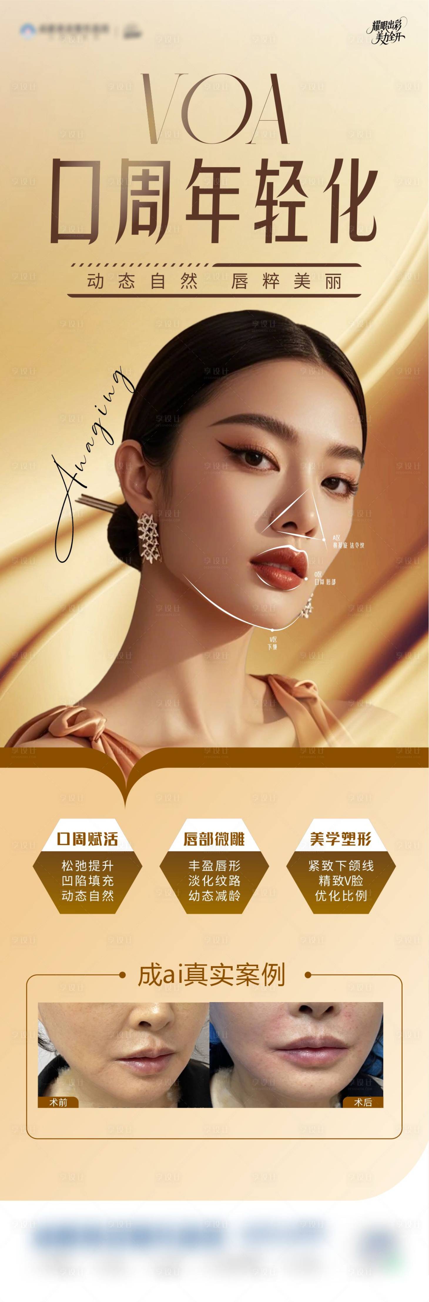 源文件下載【享設計】搜索編號：41600030892264325【VOA口周年輕化】