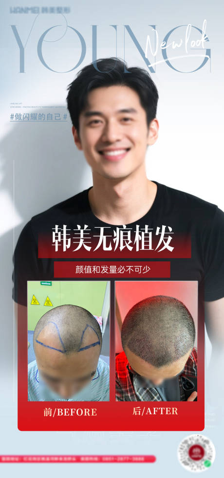 源文件下載【醫(yī)美植發(fā)案例海報(bào)】編號(hào)：73210030872656013