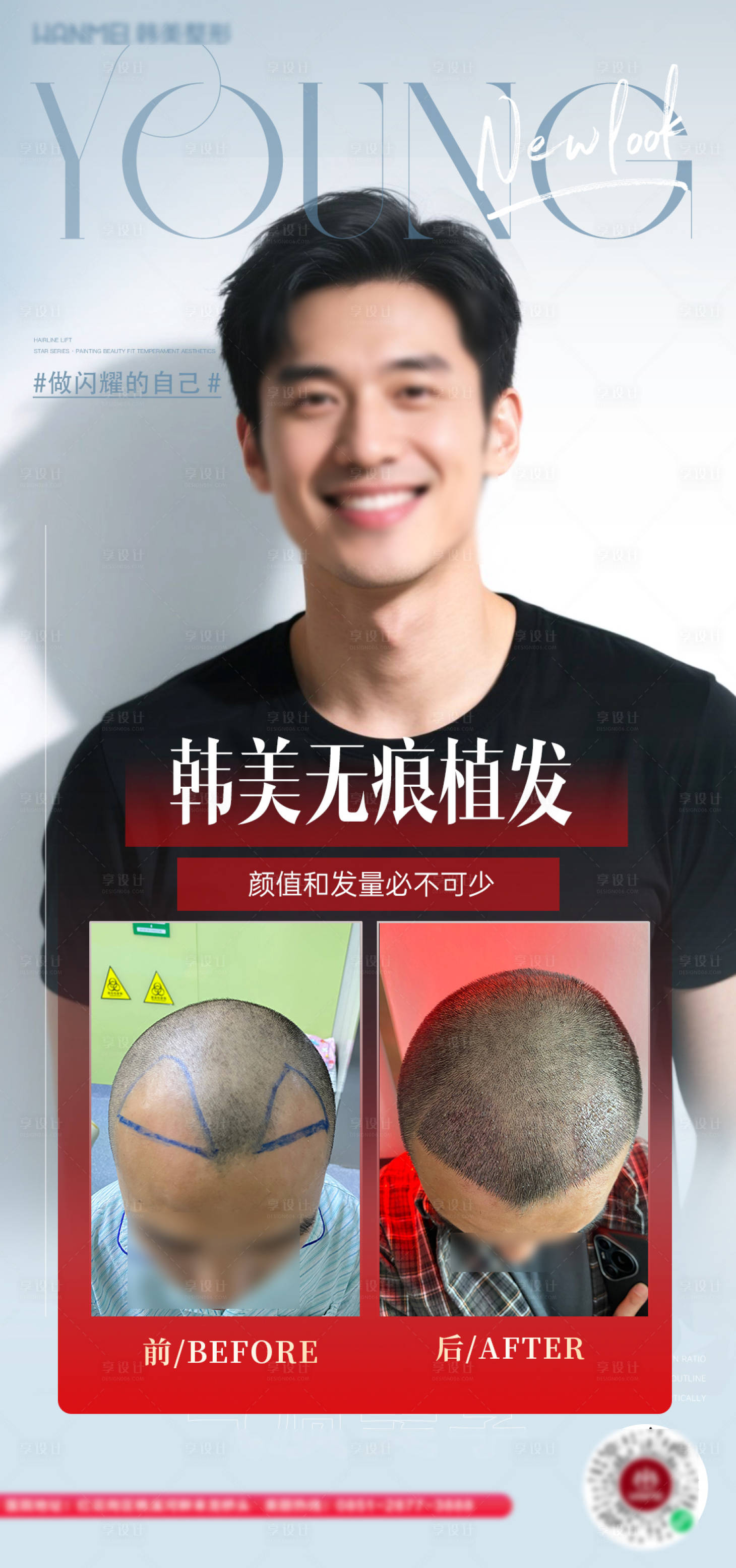 源文件下載【醫美植發案例海報】編號：73210030872656013