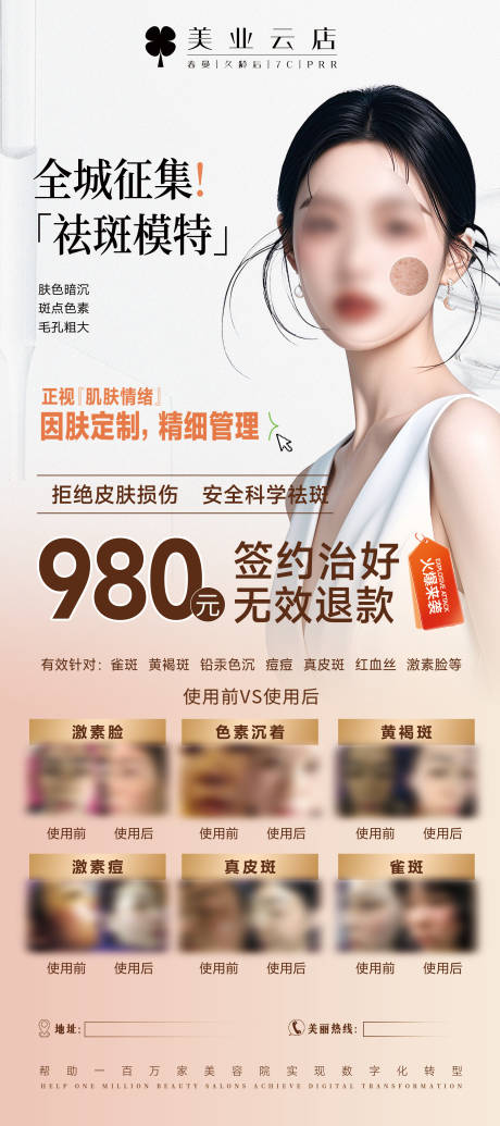 源文件下载【医美易拉宝广告】编号：34140029700701550