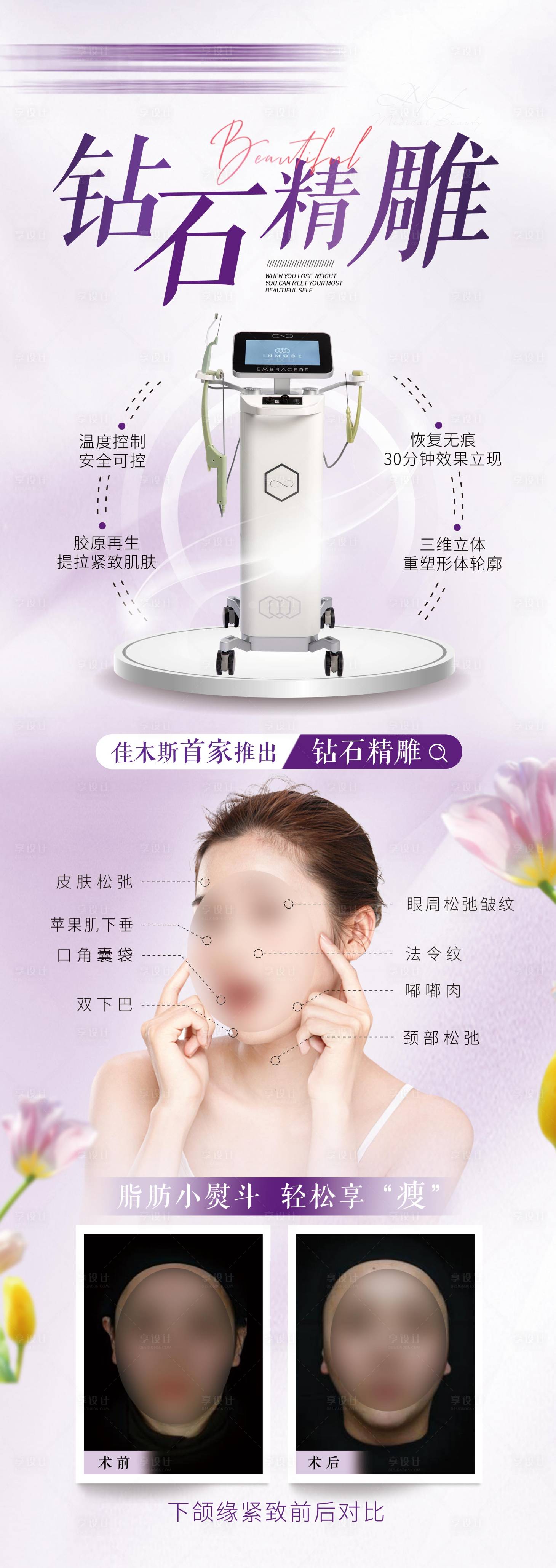 源文件下载【享设计】搜索编号：64660030733871292【钻石精雕面部对比图】