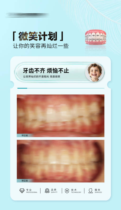 源文件下载【享设计】搜索编号：27760030572396406【口腔正畸牙齿矫正案例对比海报】