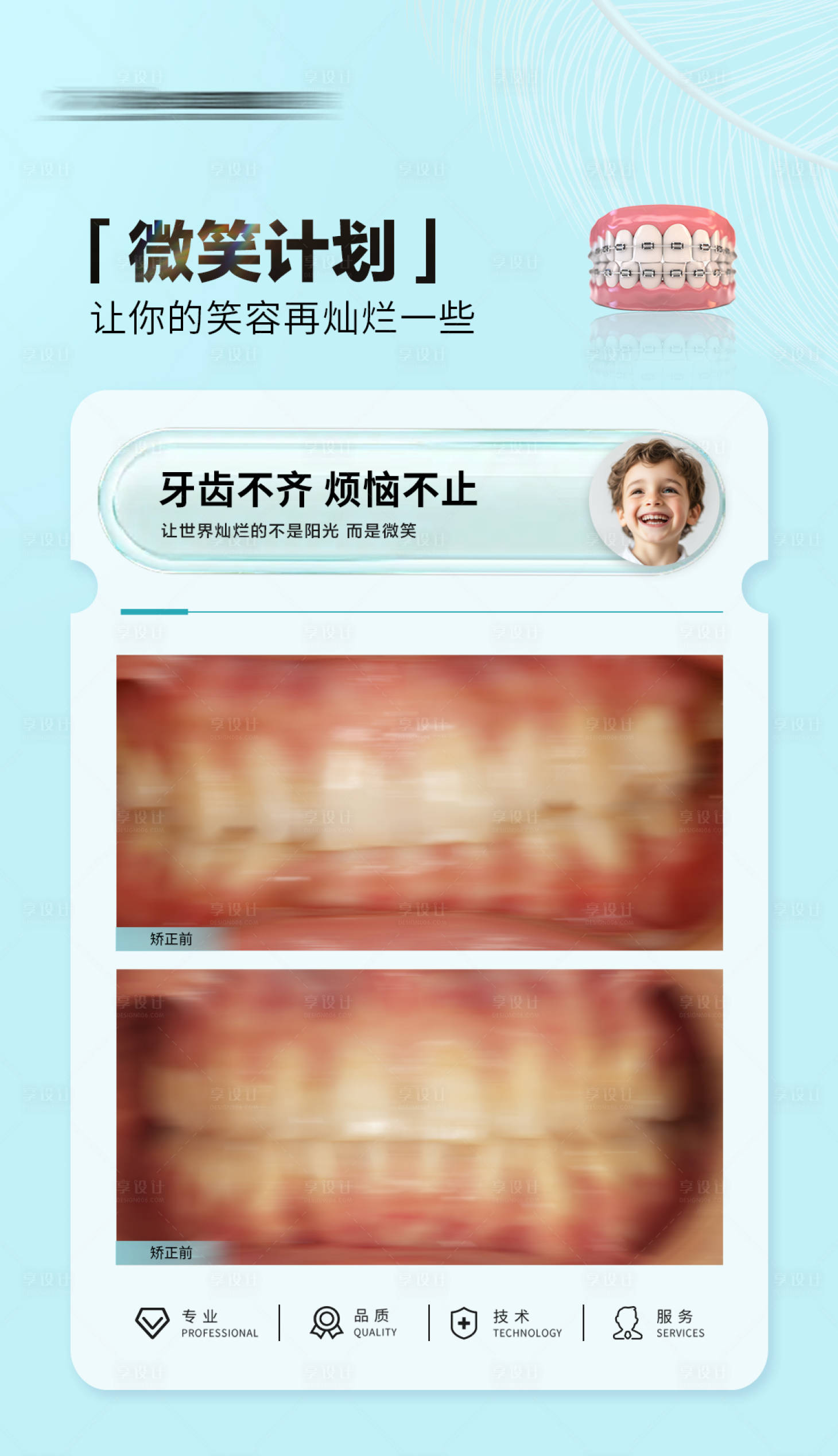 源文件下載【享設計】搜索編號：27760030572396406【口腔正畸牙齒矯正案例對比海報】