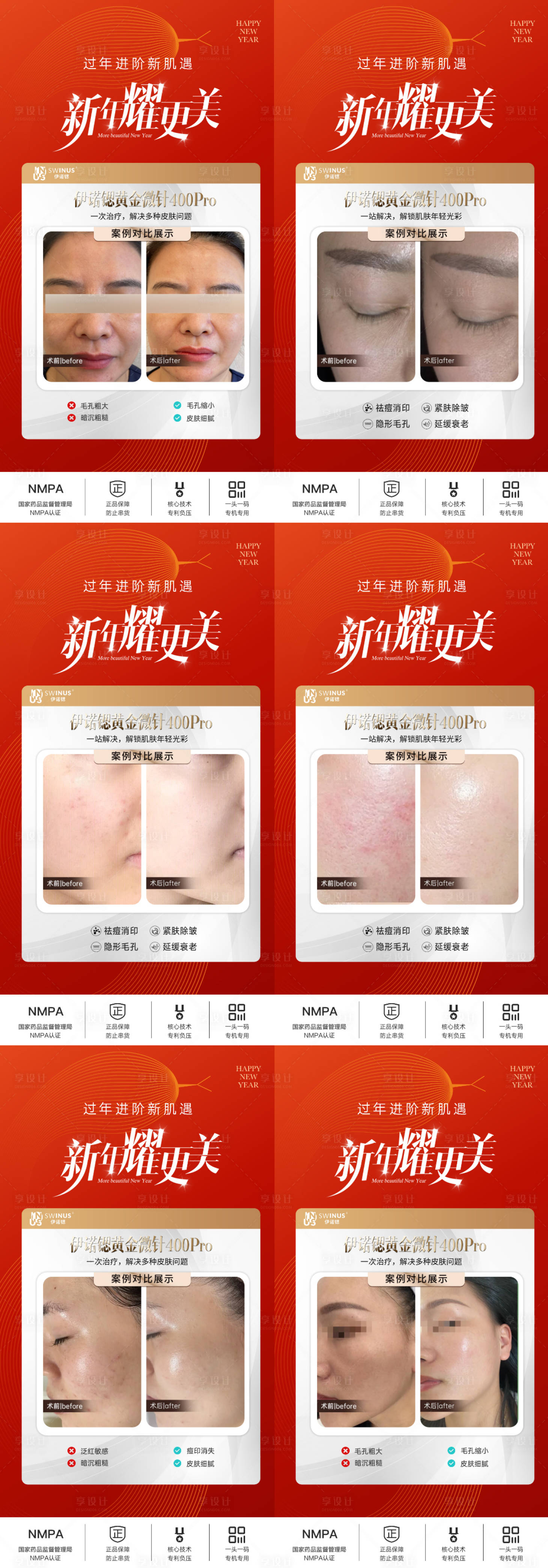 源文件下载【享设计】搜索编号：50450030705282190【伊诺锶黄金微针医美创意海报】