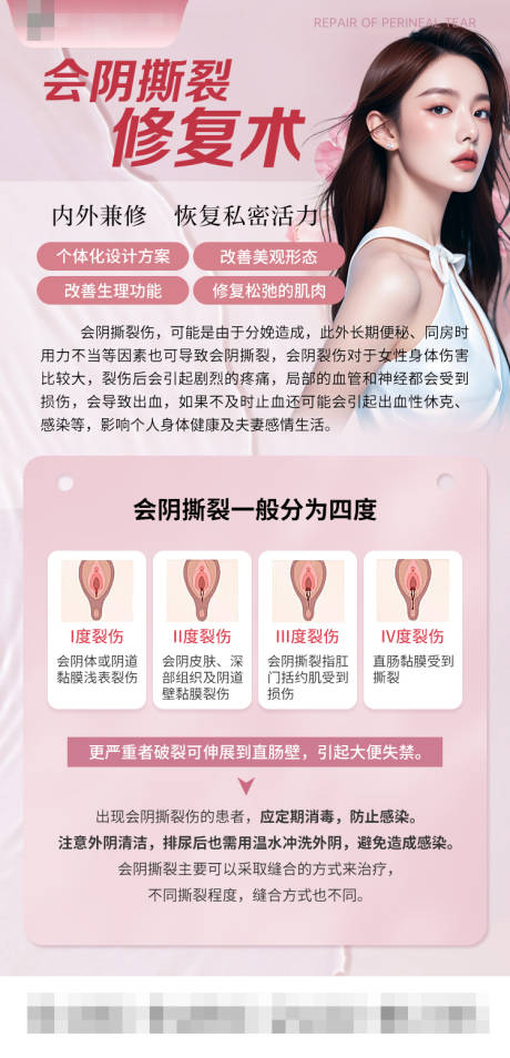 源文件下载【享设计】搜索编号：87220030838163741【会阴撕裂修复术海报】