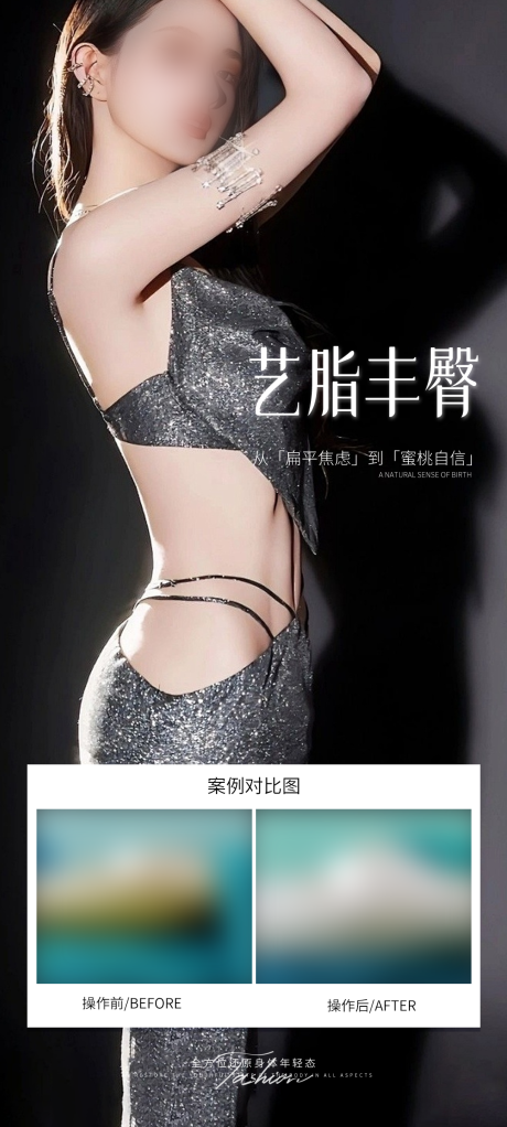 源文件下載【享設(shè)計】搜索編號：51370031091661025【醫(yī)美豐臀案例海報】