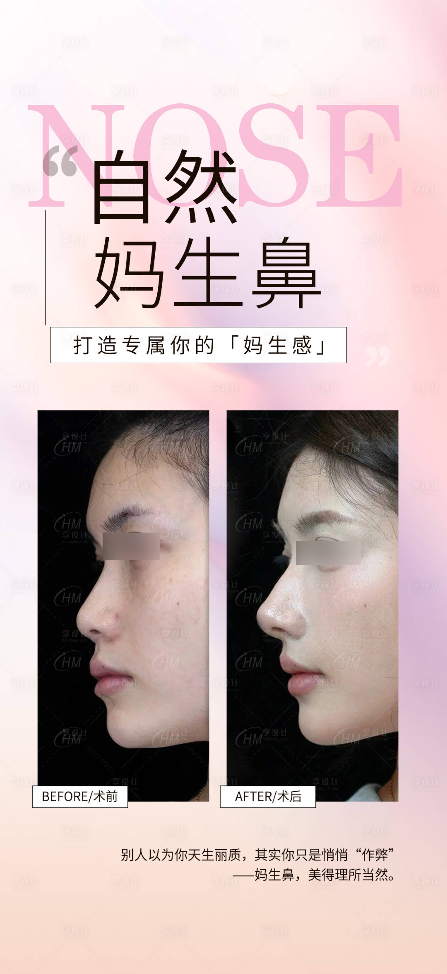 源文件下载【享设计】搜索编号：24300030692402838【自然妈生鼻案例海报】