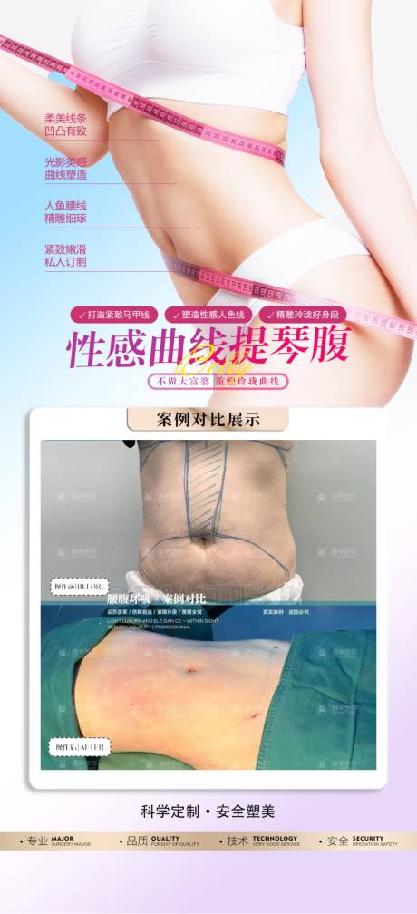 源文件下载【腰腹吸脂案例】编号：72800030557542557