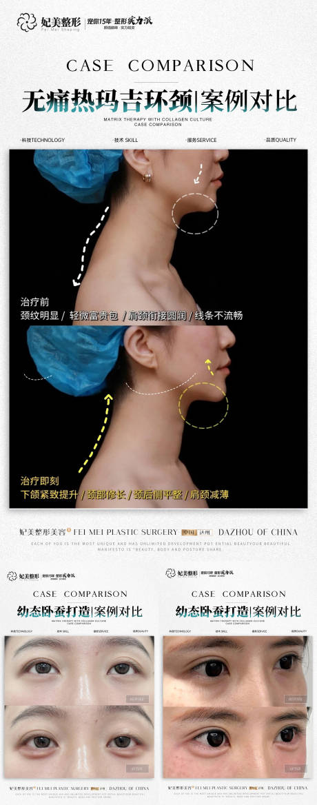 源文件下載【醫美案例簡約系列海報】編號：94190030657998098