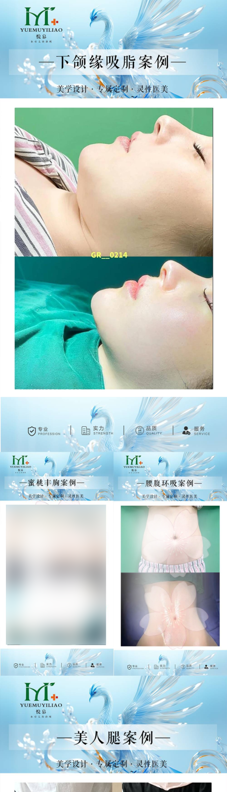 源文件下载【整形案例系列海报】编号：42370030393977477