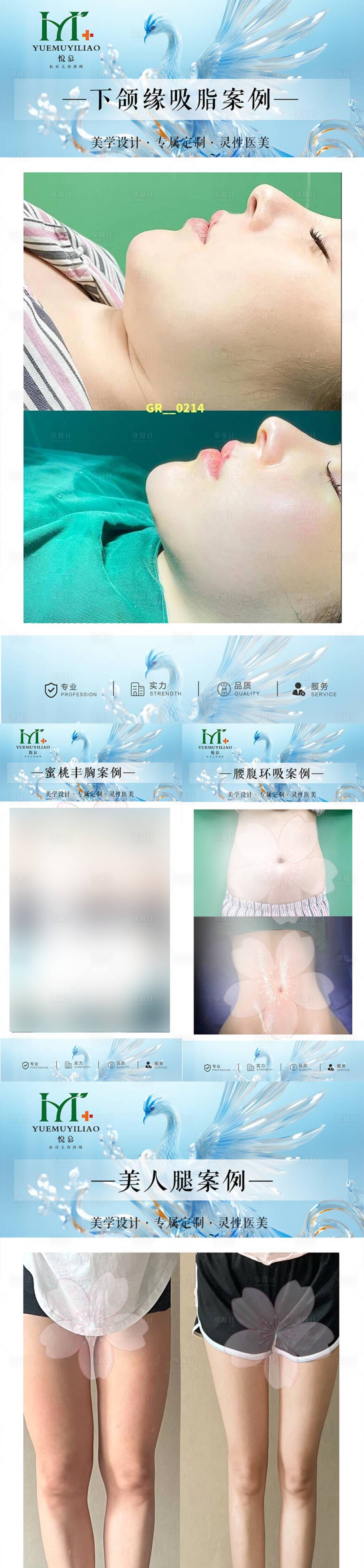 源文件下載【享設計】搜索編號：42370030393977477【整形案例系列海報】