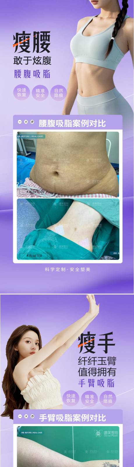 源文件下载【腰腹手臂吸脂案例】编号：44460030822015676