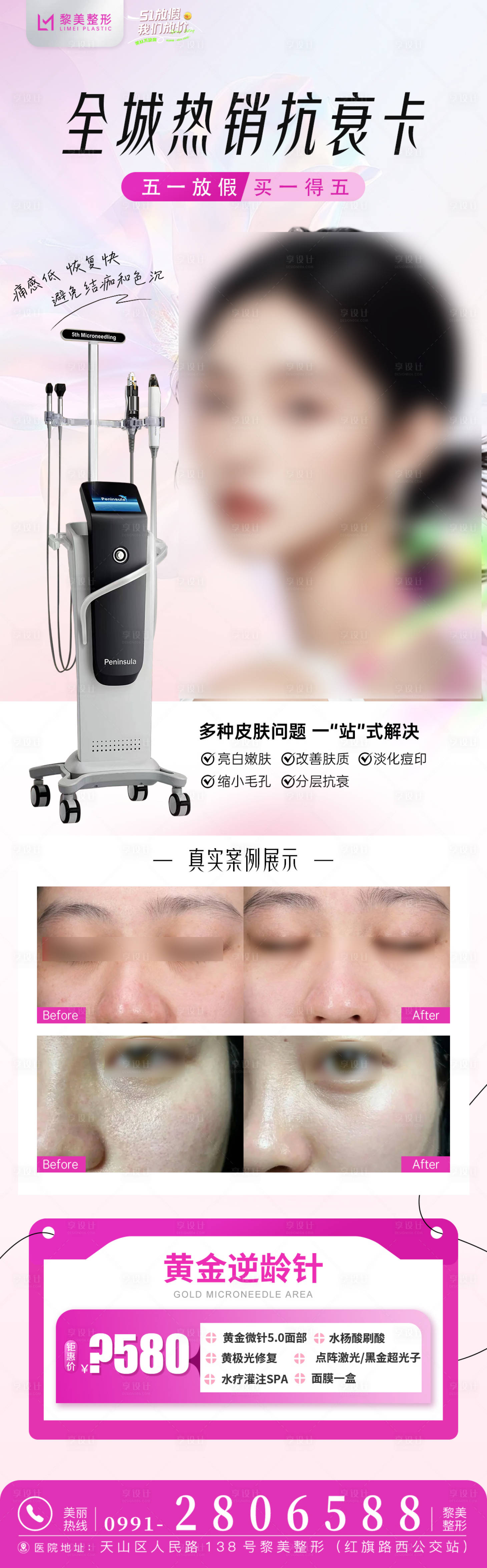 源文件下載【享設計】搜索編號：14810030512452275【醫美黃金微針5.0 】