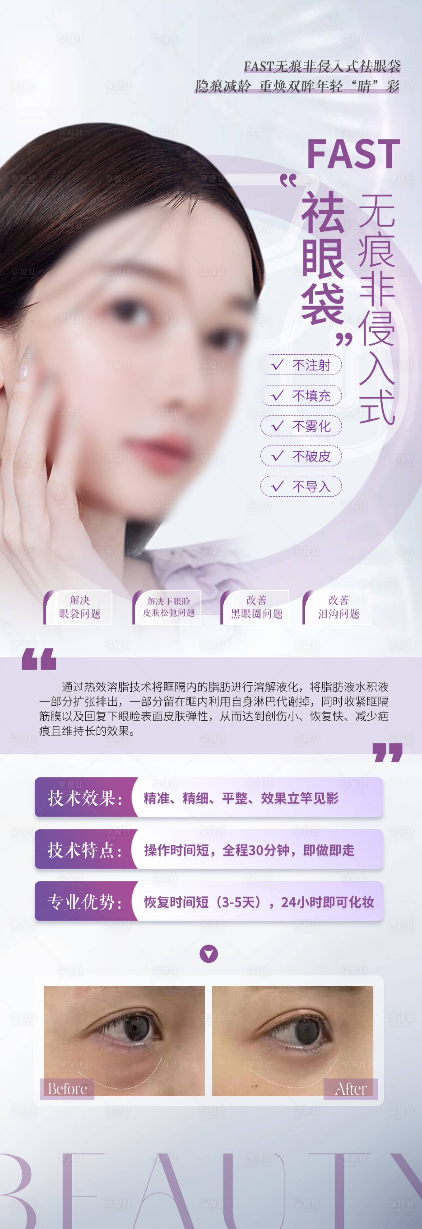 源文件下载【享设计】搜索编号：82360031081619844【医美祛眼袋案例详情】