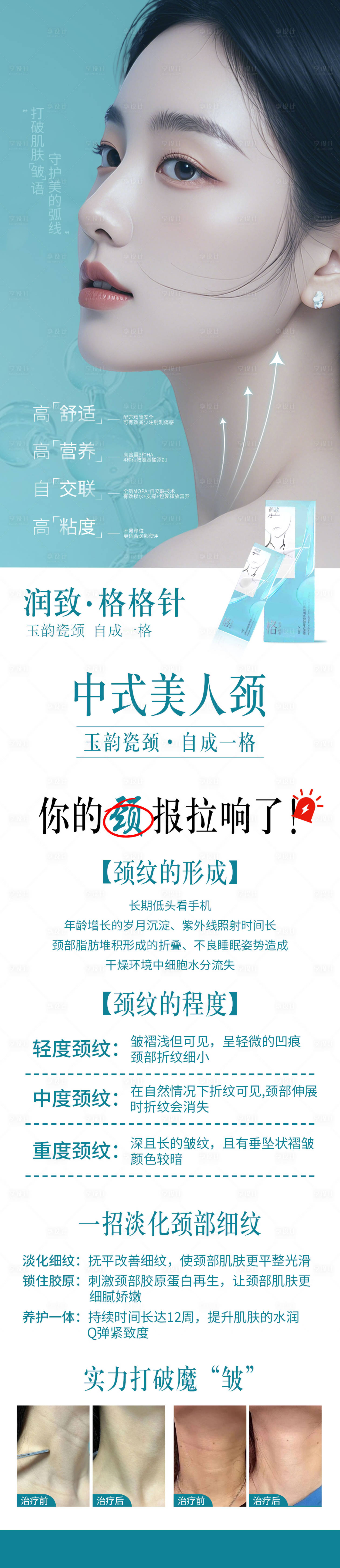源文件下载【享设计】搜索编号：55840030557652918【润致格格针海报】