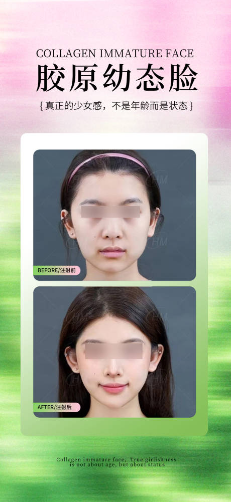 源文件下载【胶原幼态脸案例】编号：18930030796271986