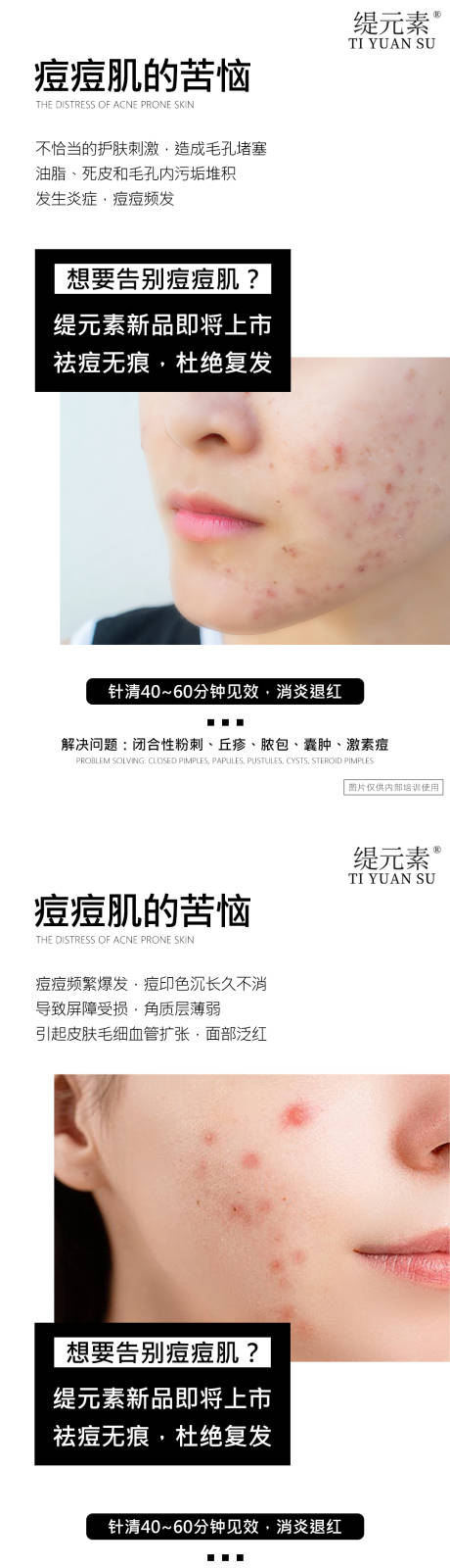 源文件下载【痘痘肌】编号：39730030780865661