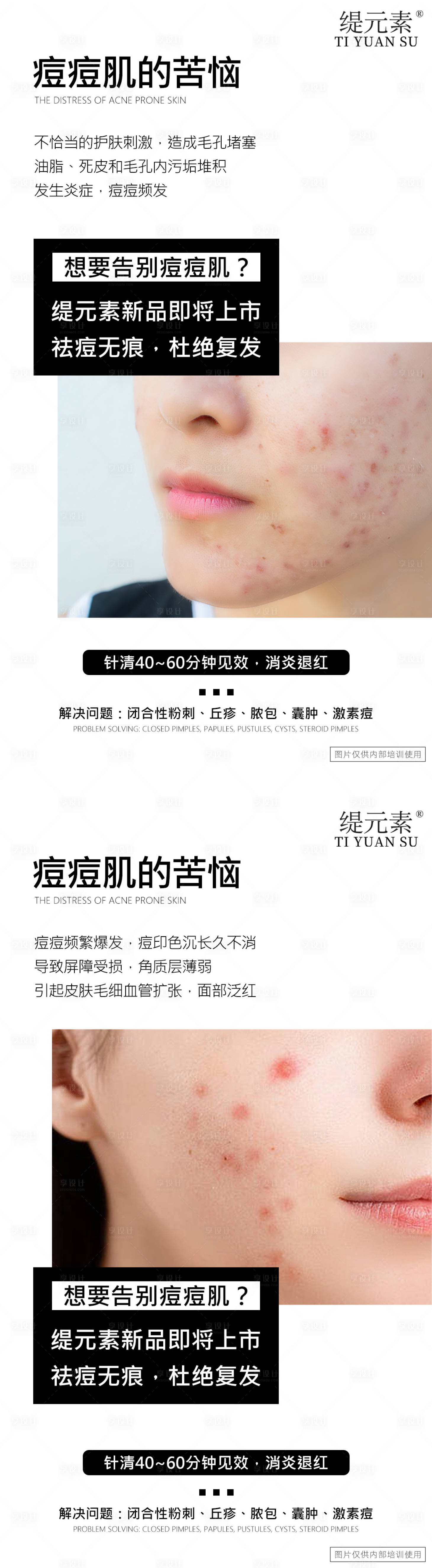 源文件下載【享設(shè)計】搜索編號：39730030780865661【痘痘肌】