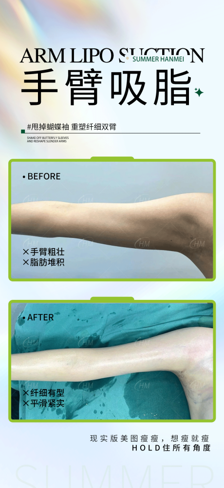 源文件下載【手臂精雕案例海報(bào)】編號(hào)：72610031009105464