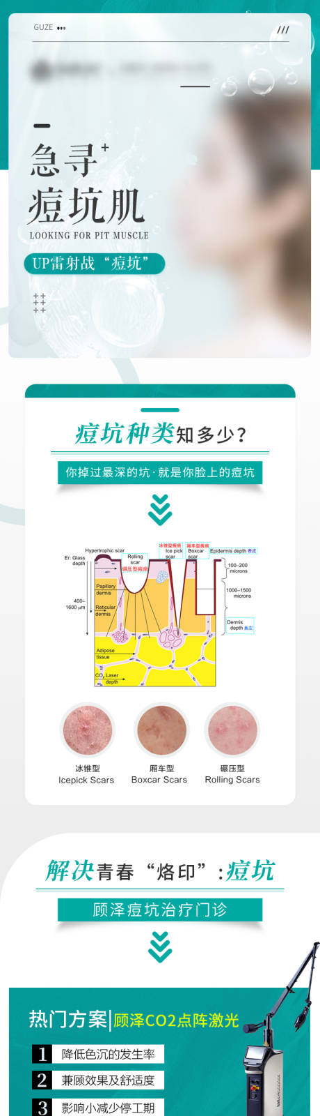 医美急寻痘坑肌长图