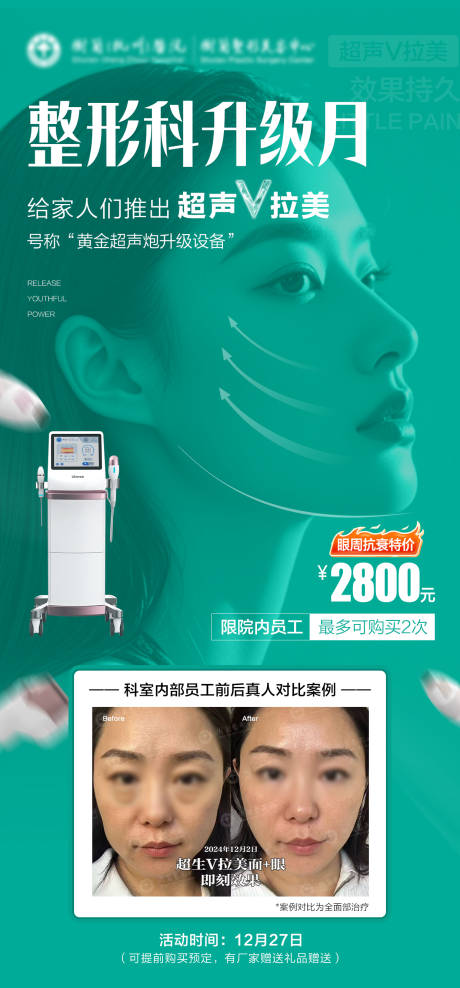 超声V拉美海报