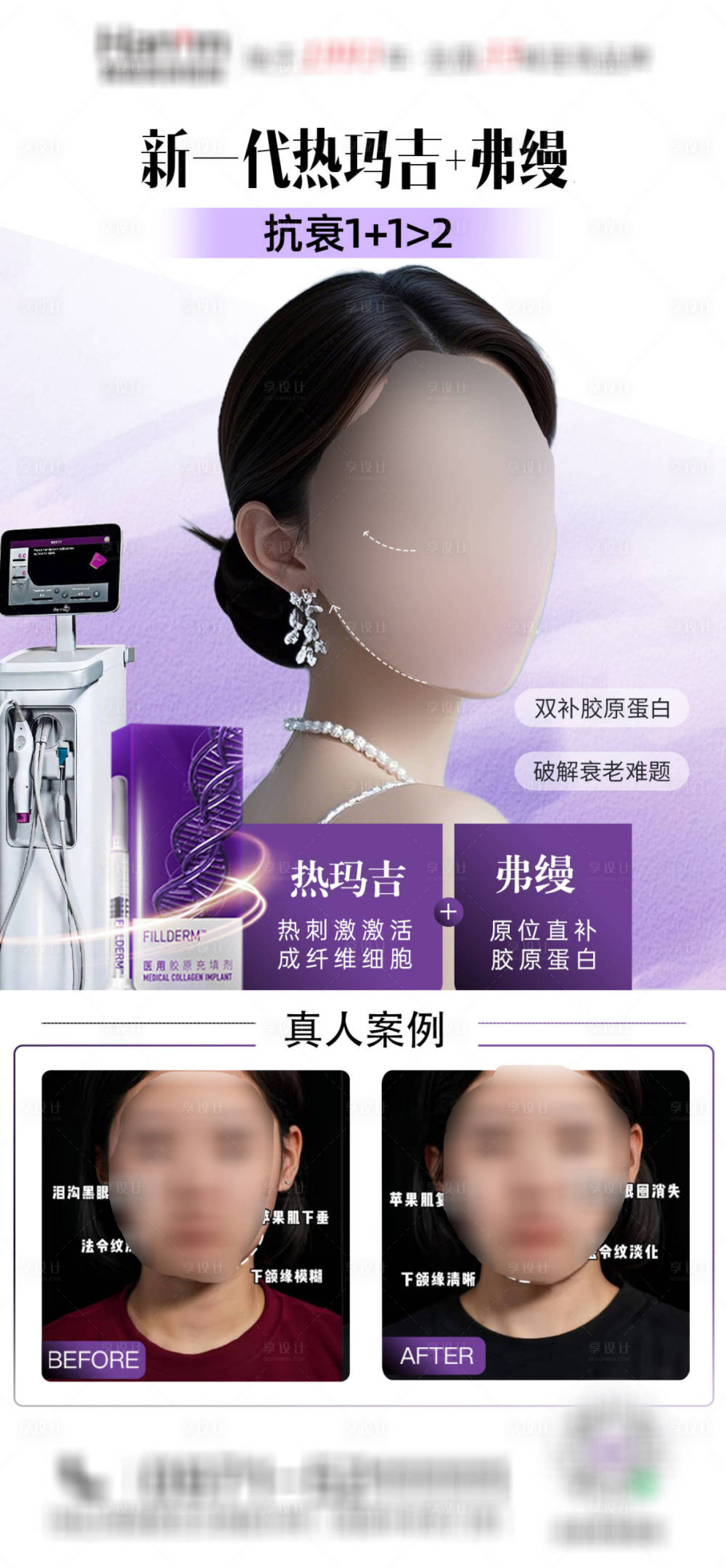 源文件下載【享設計】搜索編號：84460030132292048【醫美熱瑪吉弗縵海報】