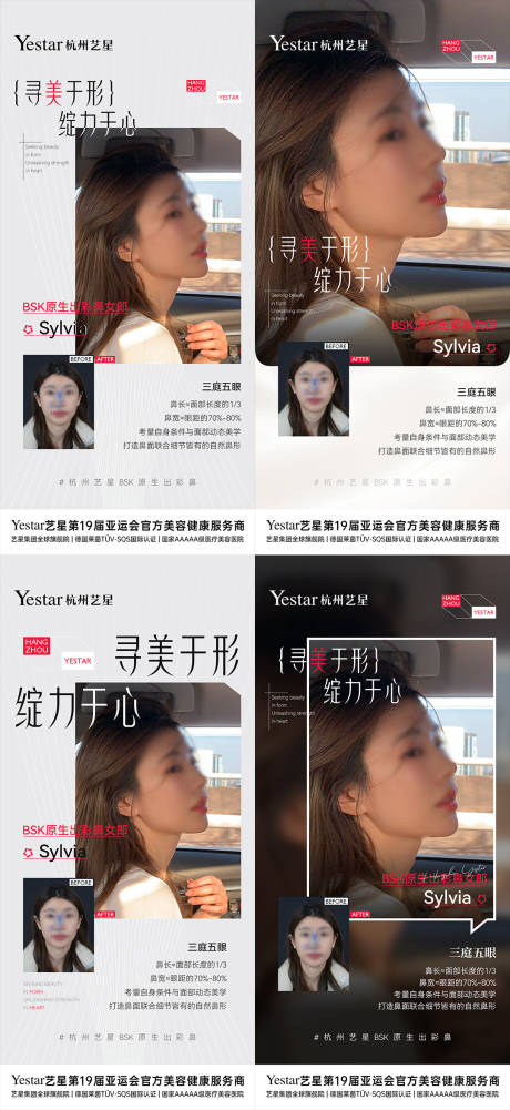 源文件下载【BSK原生出彩鼻案例对比】编号：17430030781821717