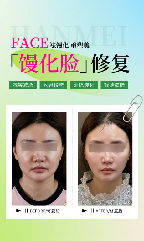 医美馒化脸修复案例海报