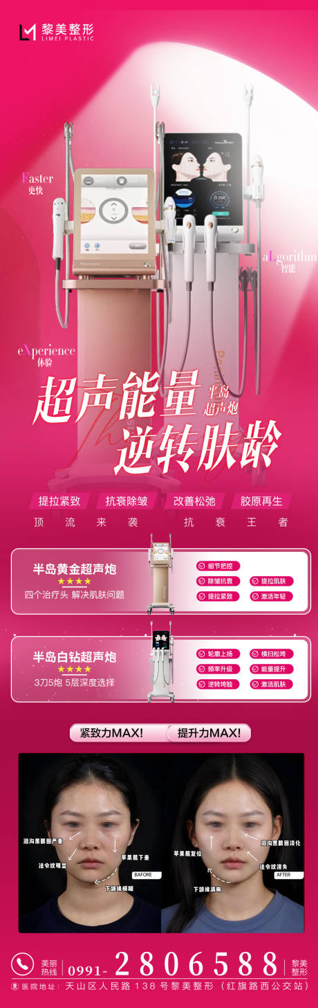 源文件下载【半岛超声炮抗衰仪器科普带案例】编号：34640030945002961