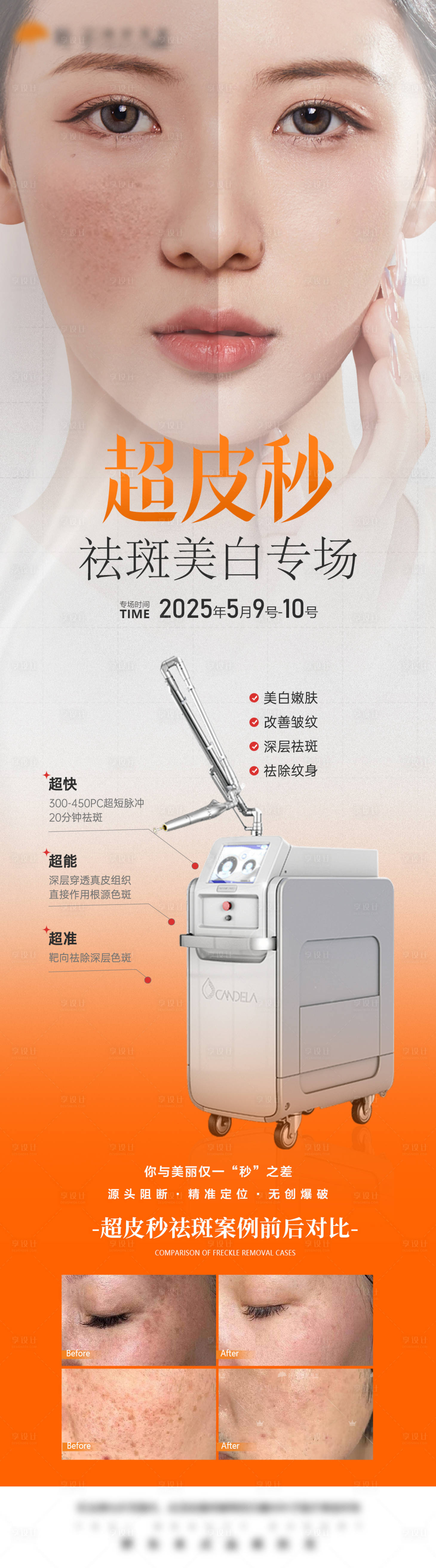源文件下载【享设计】搜索编号：93680030909254197【医美超皮秒专场海报】
