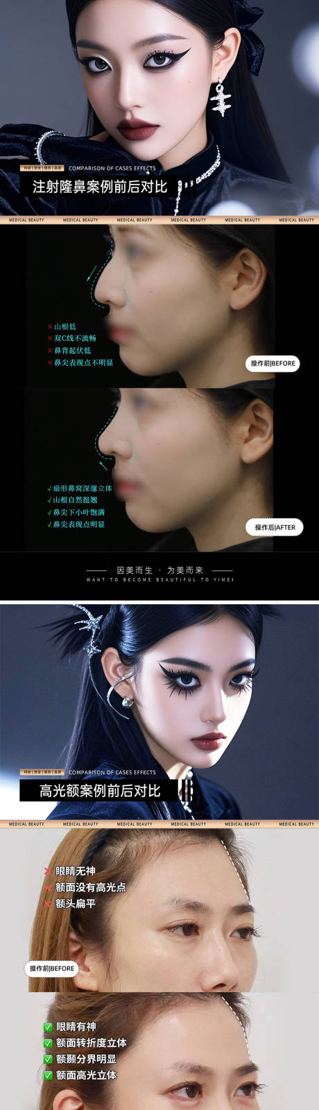 源文件下载【医美案例对比模板】编号：97050030806558891
