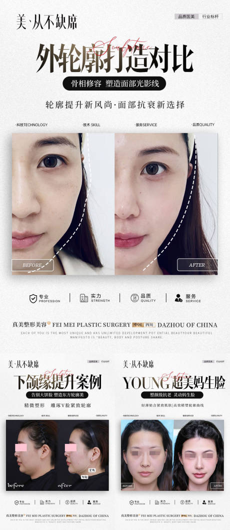 美业简约案例对比系列海报