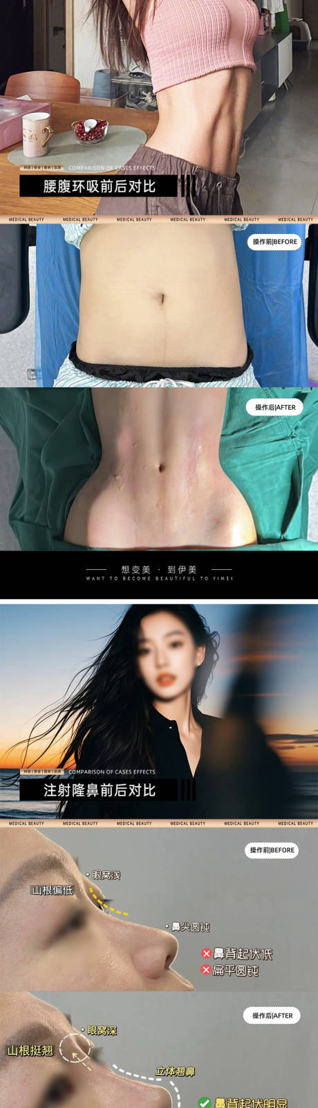 源文件下载【医美案例对比模板海报】编号：79280030544443261