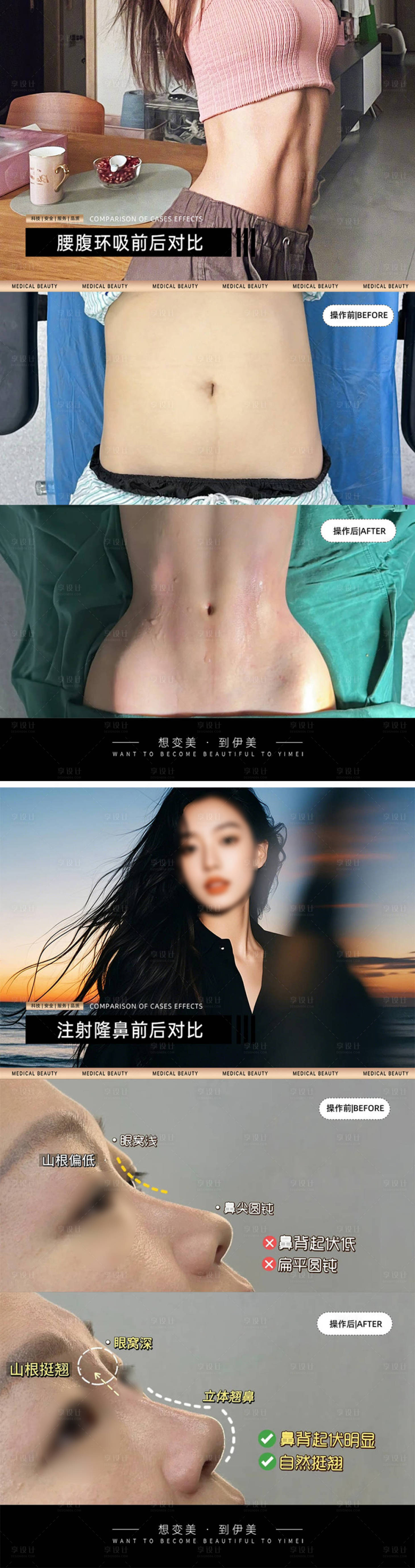 源文件下載【享設計】搜索編號：79280030544443261【醫美案例對比模板海報】